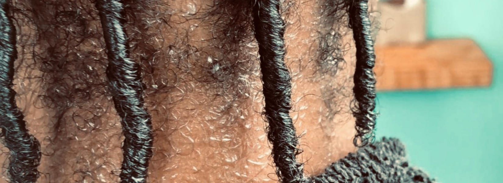 Facts on Thinning Hair